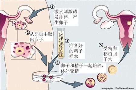供卵代孕要多少费用